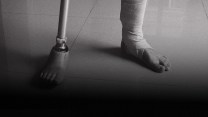 Close-up of a man's feet: one foot is bandaged and the other is a prosthetic limb. A dark gradient encroaches from the bottom of the image, threatening to cover the man's feet.